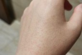 手机拍照出现小点点怎么消除？有效方法是什么？
