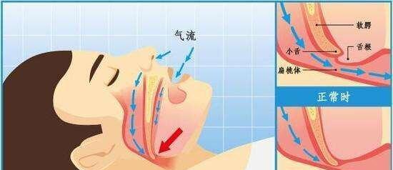 电脑睡眠后为何会间断发出声音？  第1张