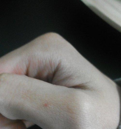 手机拍照出现小点点怎么消除？有效方法是什么？  第3张