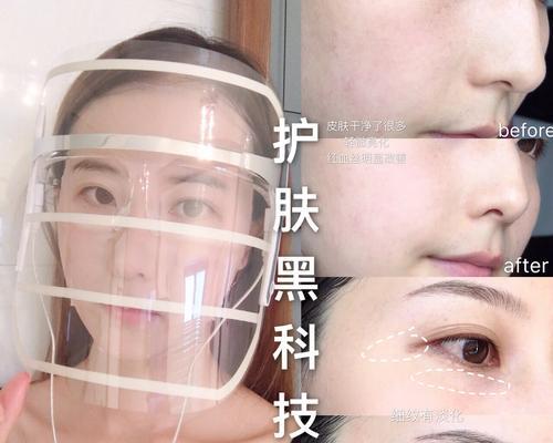 资生堂美容仪充电器使用方法是什么？  第2张